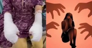 दिल्ली एसिड अटैक फर्जी निकला: रची गई थी बड़ी साजिश, पीड़िता के पिता ने तीन युवकों को फंसाने के लिए गढ़ी झूठी कहानी
